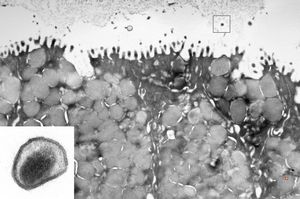 transversally cut microvillus - none virus! (stomach) transversally cut microvillus - none virus! (stomach)